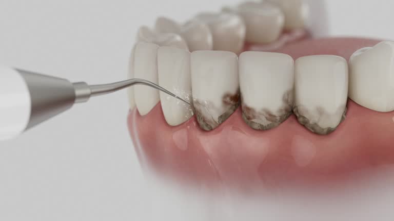 Reliable Dental contractor in Chesterton, IN by Dentist Open Now